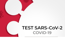 test sars-cov-2